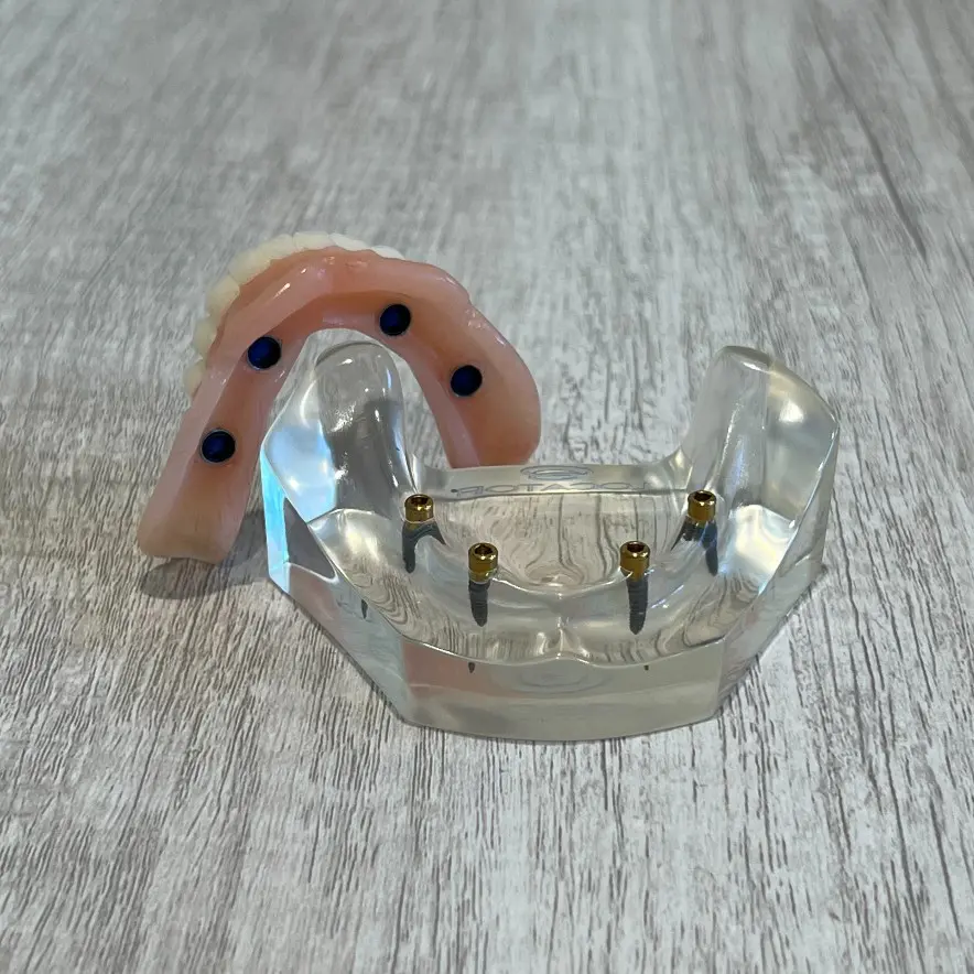 snap-in implant dentures orange county