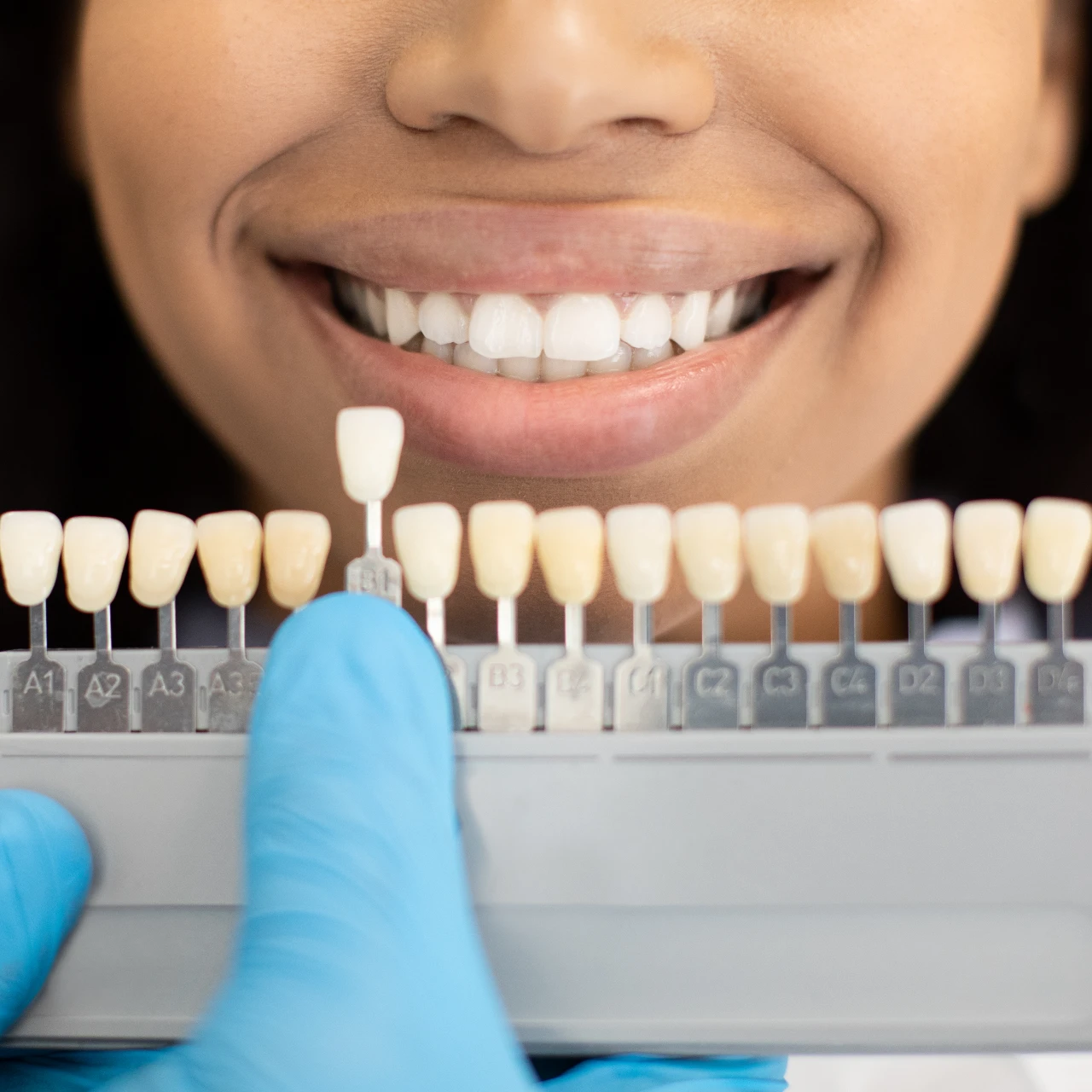 woman comparing dental veneers | veneers orange county
