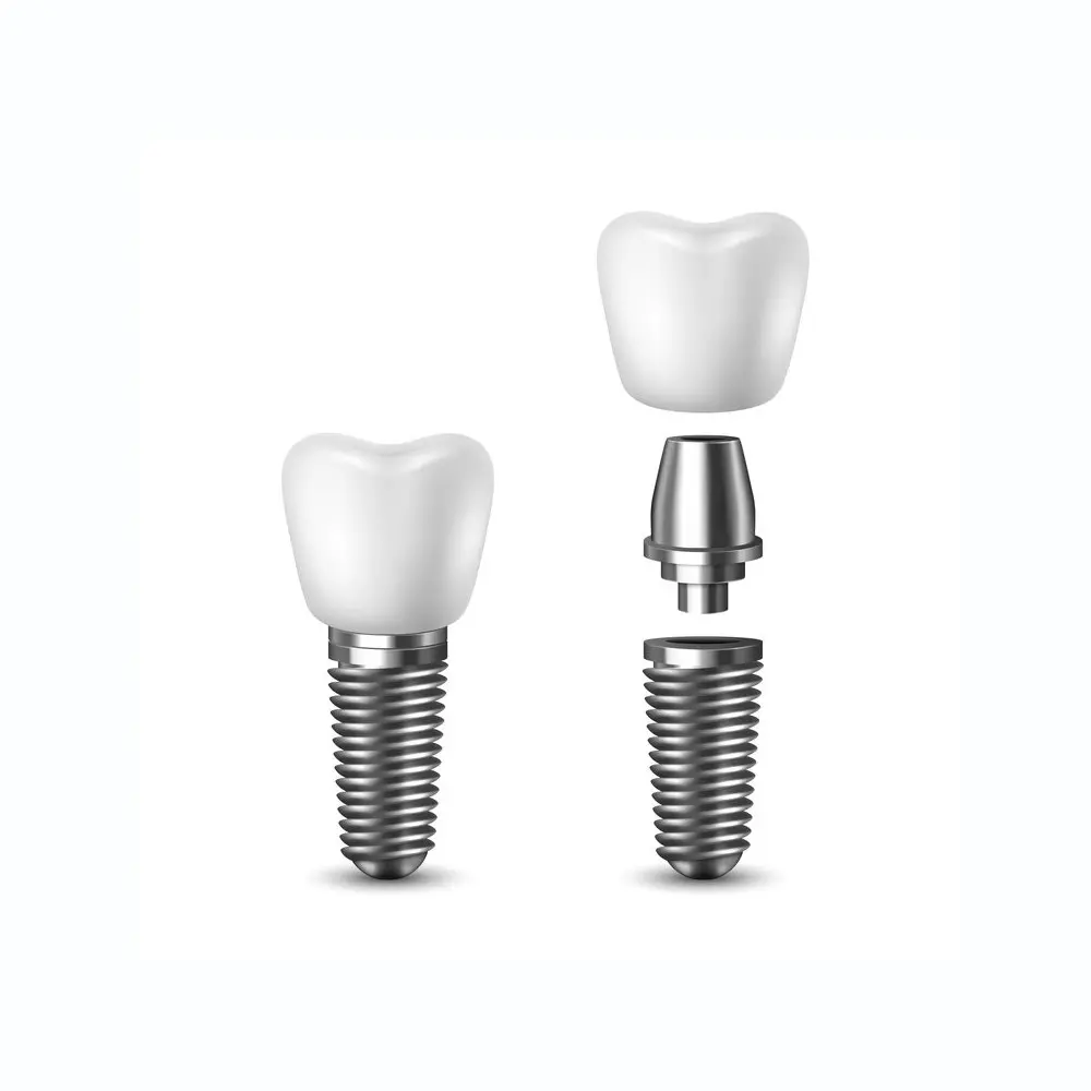 single tooth implant | dental implants orange county