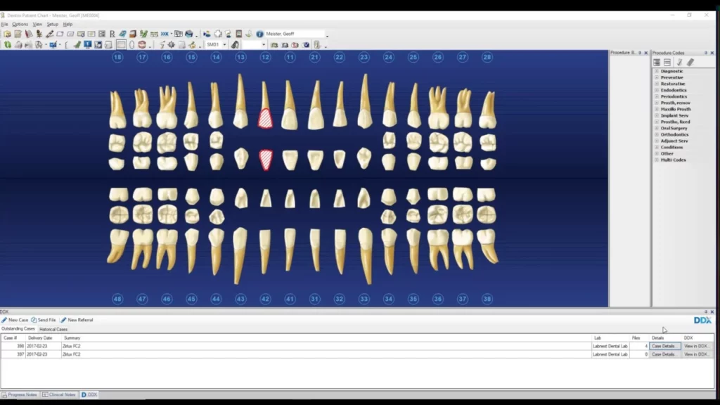 Dentrix digital charting dental technology